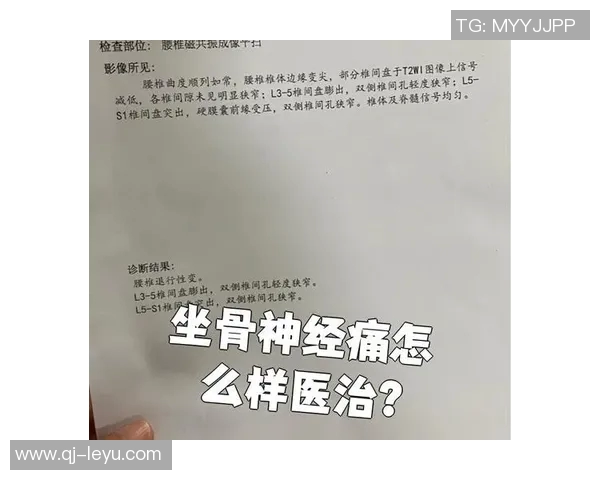 专家解读坐骨神经痛成因及治疗方法大多数患者可避免手术治疗 专家解读坐骨神经痛成因及治疗方法大多数患者可避免手术治疗